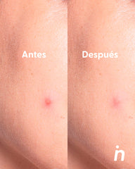 Parches con Micro Cápsulas Hidrocoloides para granitos ciegos - My Way Out x2