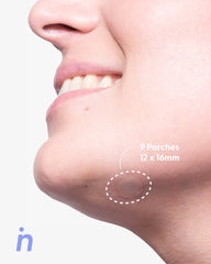 Own Your Spot Kit - Nipskin CR