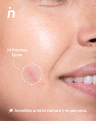 Own Your Spot Kit - Nipskin CR