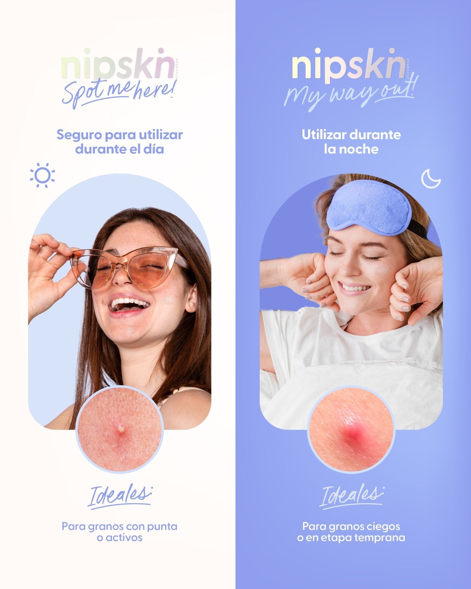 Own Your Spot Kit - Nipskin CR