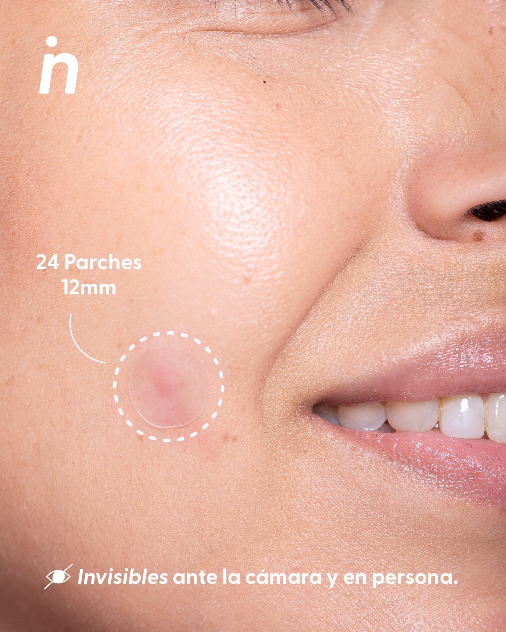 Parches Hidrocoloides Invisibles para Granitos - Spot Me Here x2 - Nipskin CR