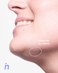 Patch You Later Kit - Nipskin CR